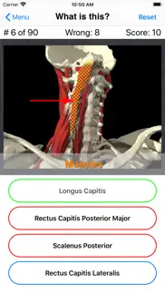 anatomy spine quiz problems & solutions and troubleshooting guide - 1