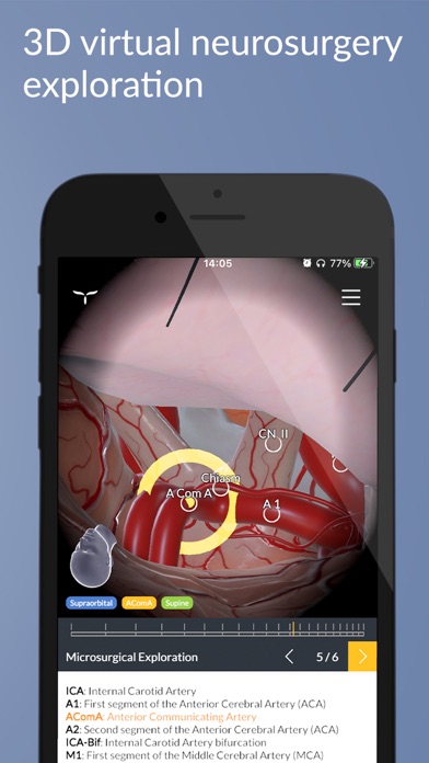UpSurgeOn Neurosurgery Screenshot