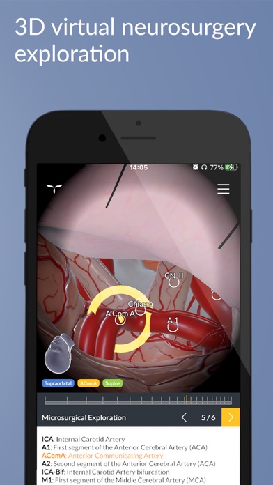 UpSurgeOn Neurosurgeryのおすすめ画像6