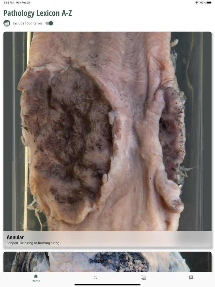 Pathology Lexicon A-Z