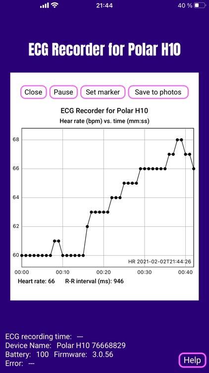 ECG EKG Recorder for Polar H10 screenshot-6