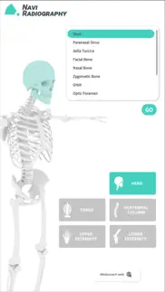 navi radiography pro iphone screenshot 1