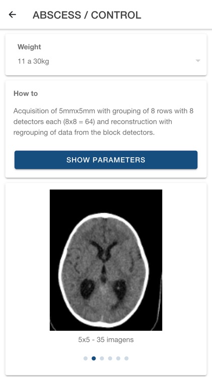 Pediatric CT Protocols screenshot-3