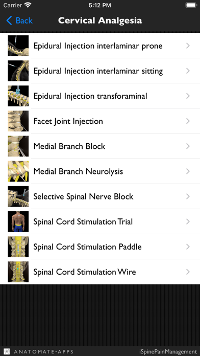iSpinePainManagement Screenshot