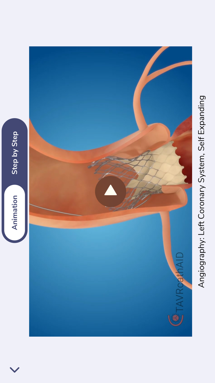 TAVRcathAID