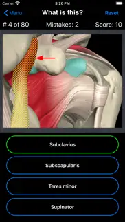 anatomy shoulder quiz iphone screenshot 3