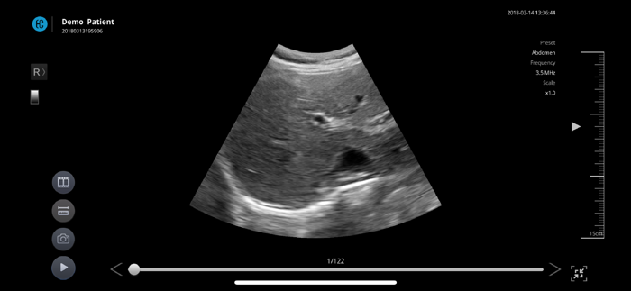 SONON X Ultrasound App US - KR