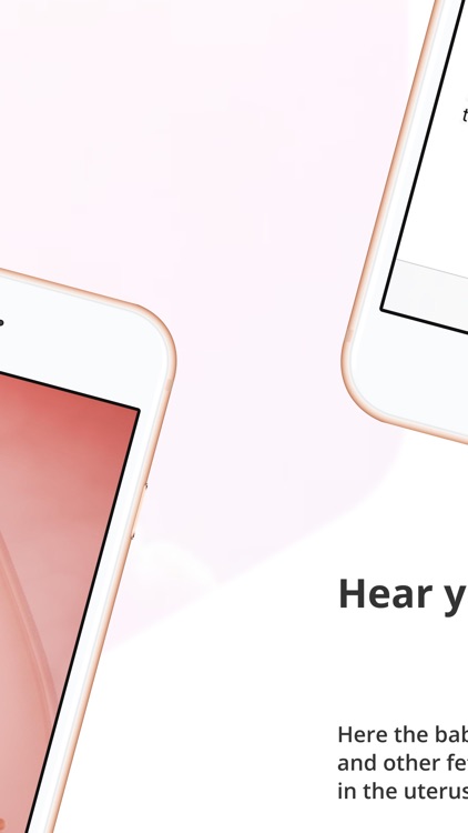 iBabyBeat-Hear Fetal Heartbeat