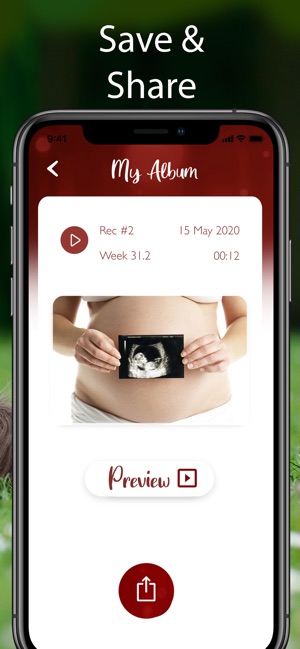 apple watch fetal heartbeat monitor