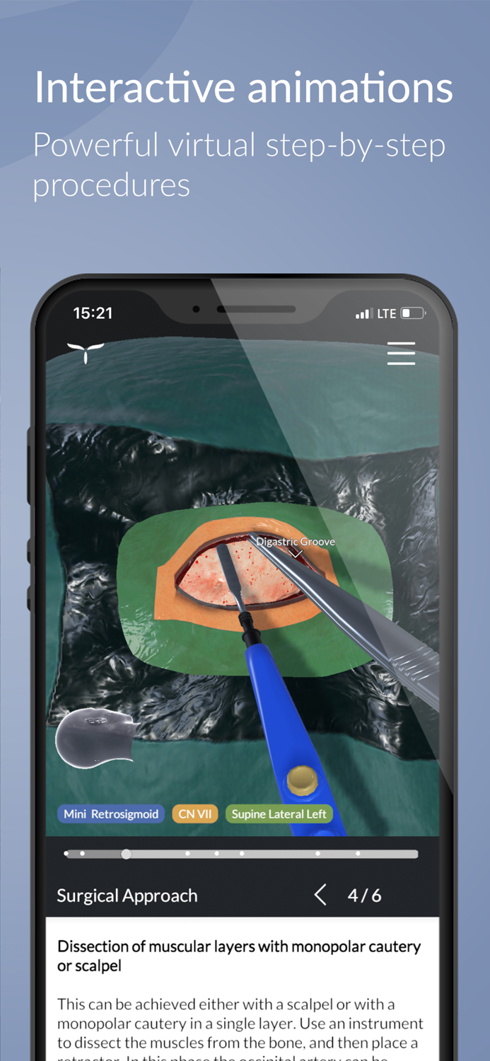 UpSurgeOn Neurosurgery