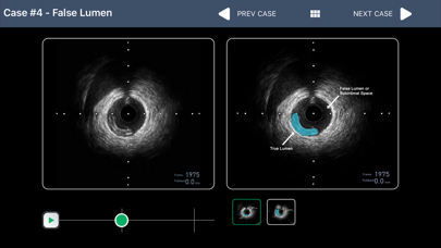 IVUS + Physiology Pro Screenshot