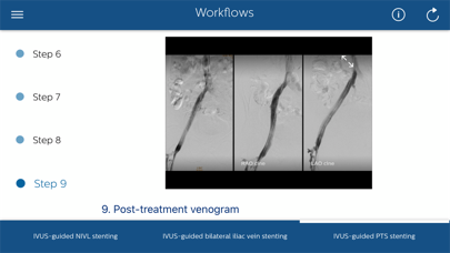 Philips Venous IVUS Tutor Screenshot