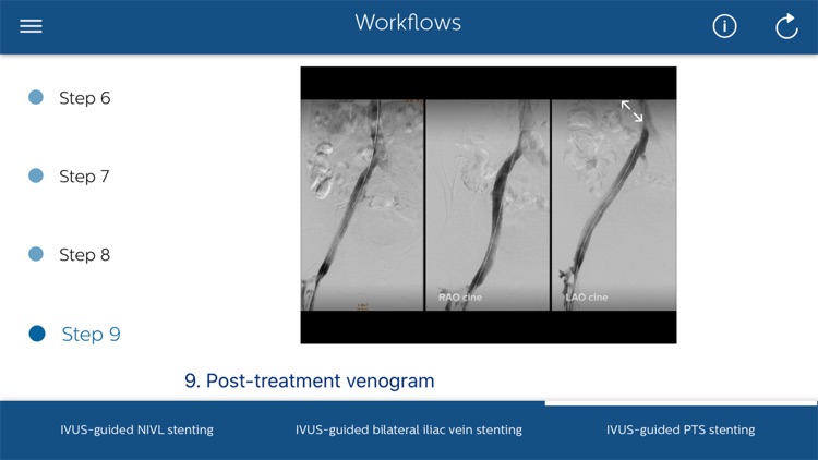 Philips Venous IVUS Tutor screenshot-7