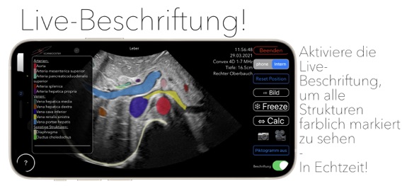 Scanbooster Ultraschallのおすすめ画像3