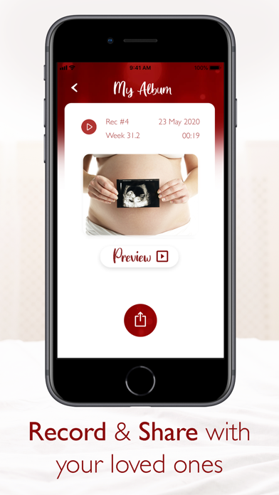 iphone fetal heartbeat app