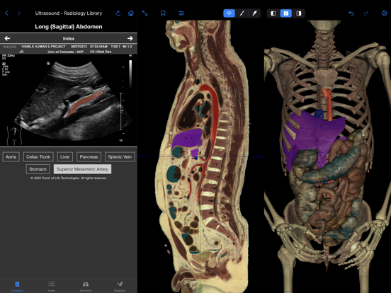 Screenshot #4 pour VH Dissector Pro