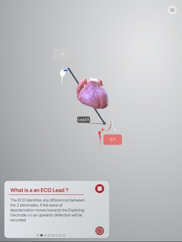 3D ECG Leadsのおすすめ画像8