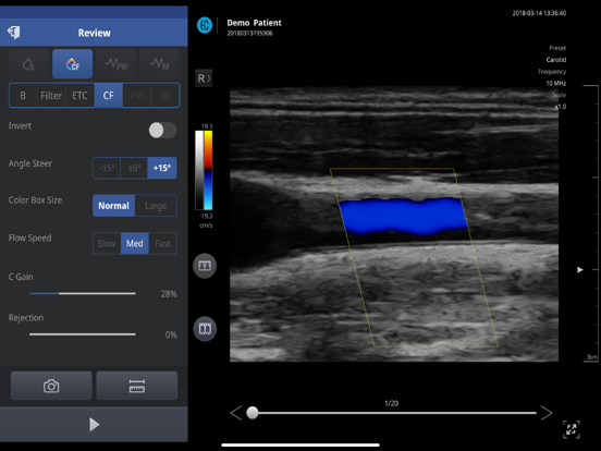 SONON X Ultrasound App US / KR iPad screenshot 2 - Medical app
