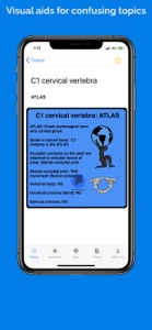 Anatnomics: Anatomy mnemonics screenshot #3 for iPhone