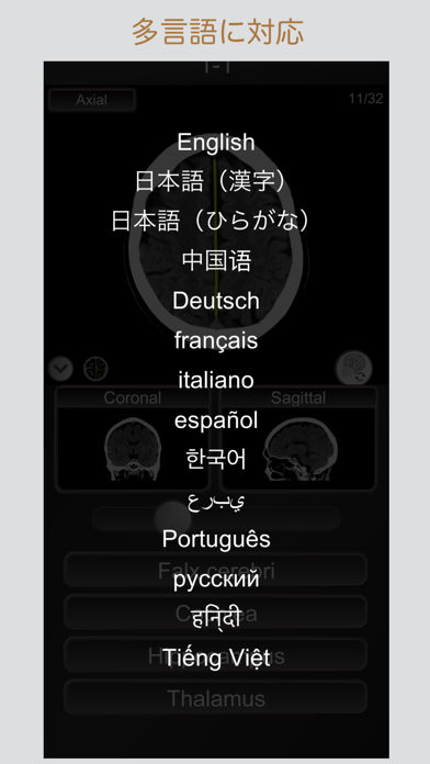 CT PassQuiz 頭部/脳 /CT断... screenshot1