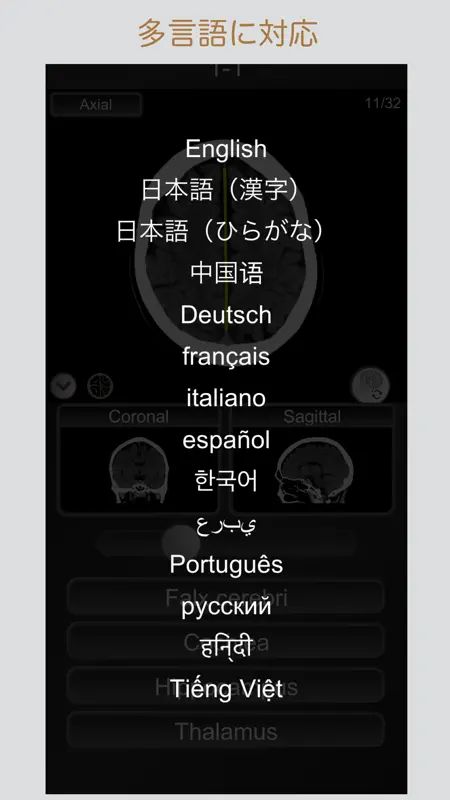 CT PassQuiz 頭部/脳 /CT断面図解剖MRI screenshot 5 of 5