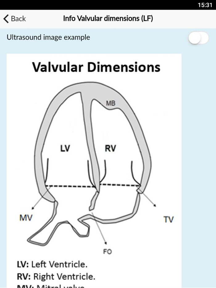 Fetal BCN Calculator