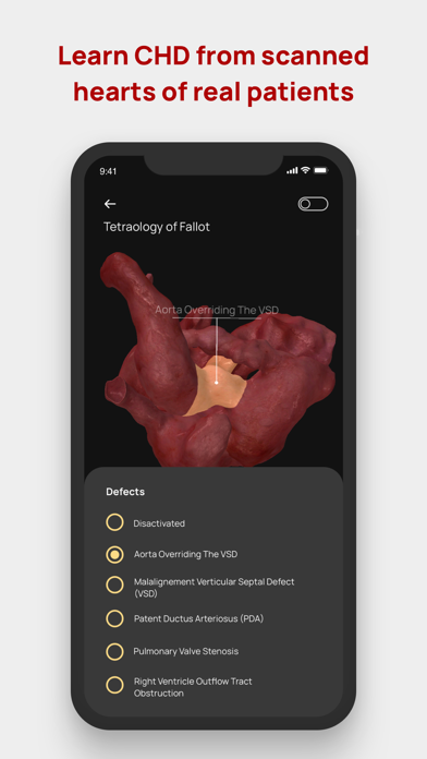Congenital heARts Screenshot