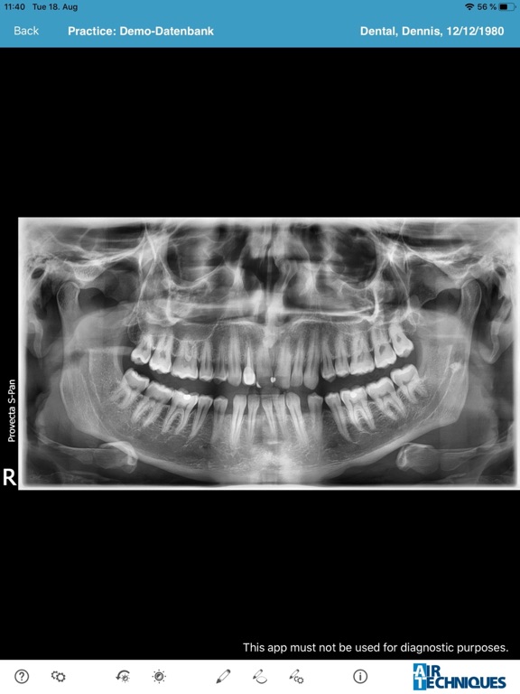 Screenshot #5 pour VisionX Imaging