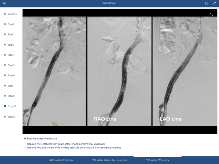 Philips Venous IVUS Tutor