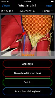 anatomy shoulder quiz iphone screenshot 4