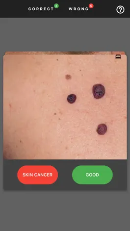 Game screenshot MelanomaExam hack