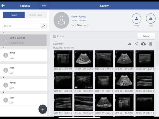 SONON X Ultrasound App US / KR iPad screenshot 1 - Medical app