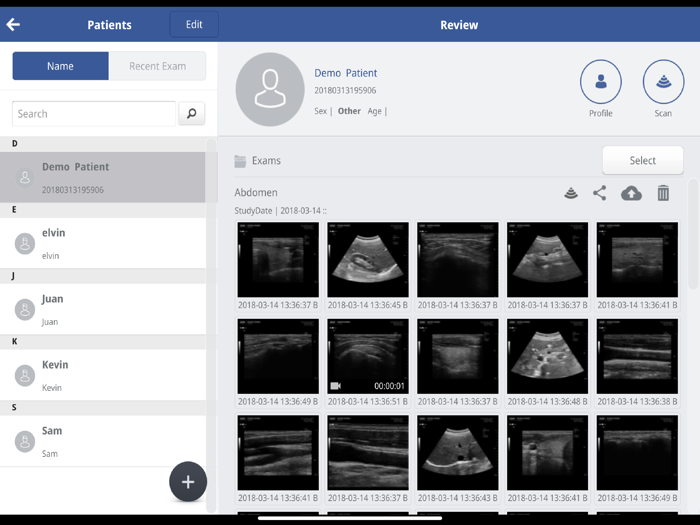 SONON X Ultrasound App US - KR