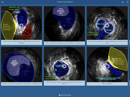 Screenshot #6 pour Philips Venous IVUS Tutor