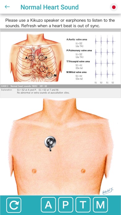 Ausculaide Screenshot