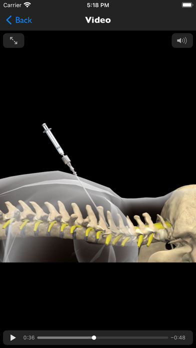 iSpinePainManagement Screenshot
