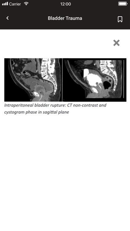 Urology screenshot-4