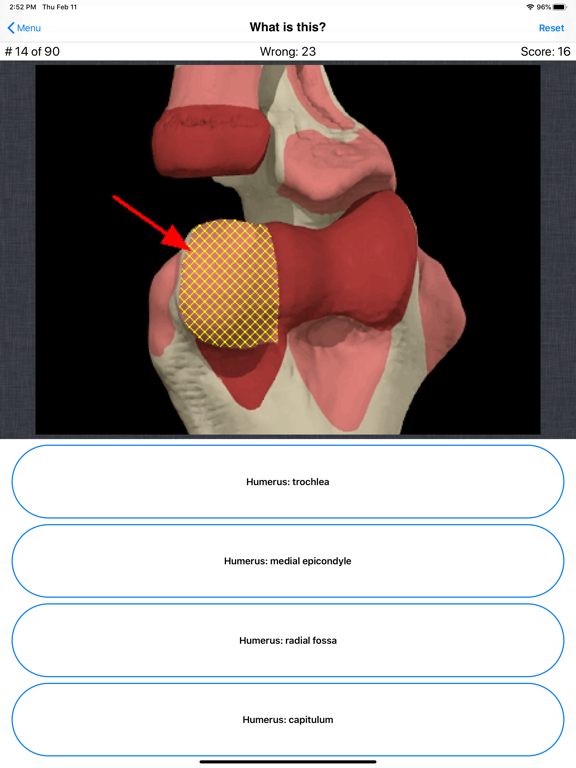 Anatomy Hand Quizのおすすめ画像5