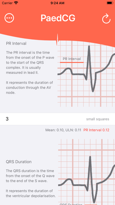 PaedCG - Paediatric ECG Screenshot