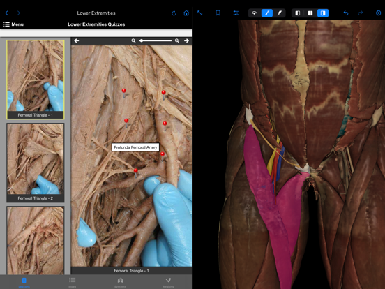 VH Dissector Pro iPad screenshot 4 - Medical app