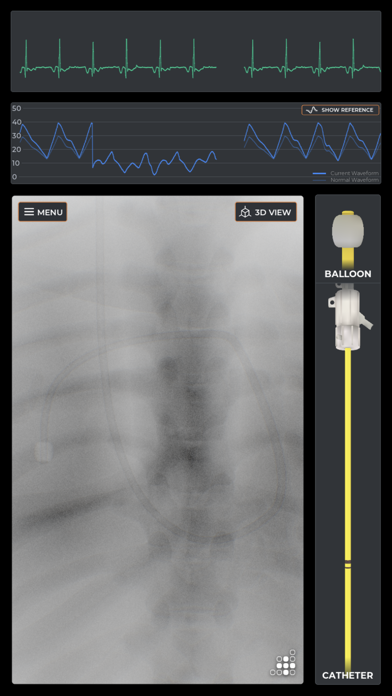 Mentice Right Heart Cath Screenshot