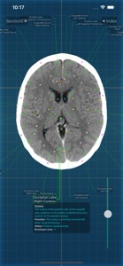 X-Anatomy Pro screenshot #8 for iPhone