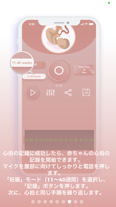 私の赤ちゃんの心拍 Iphoneアプリ Applion