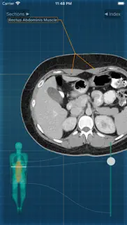 x-anatomy pro problems & solutions and troubleshooting guide - 4