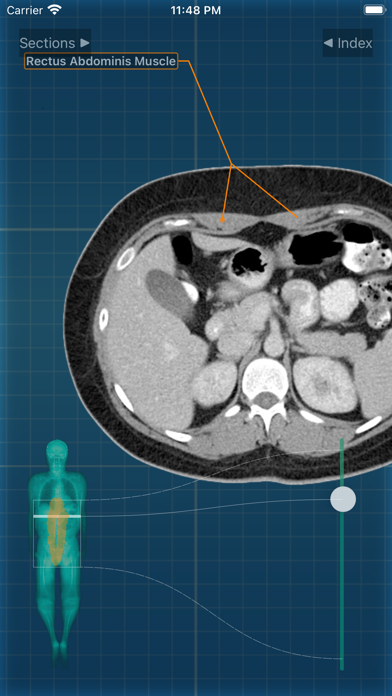 X-Anatomy Pro Screenshot