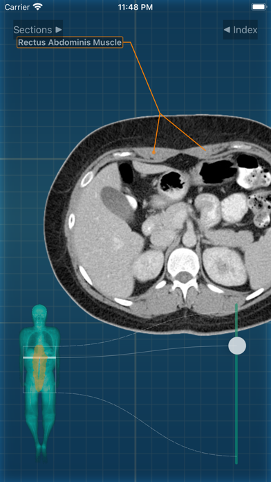 X-Anatomy Proのおすすめ画像9