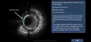 IVUS + Physiology Pro screenshot #7 for iPhone