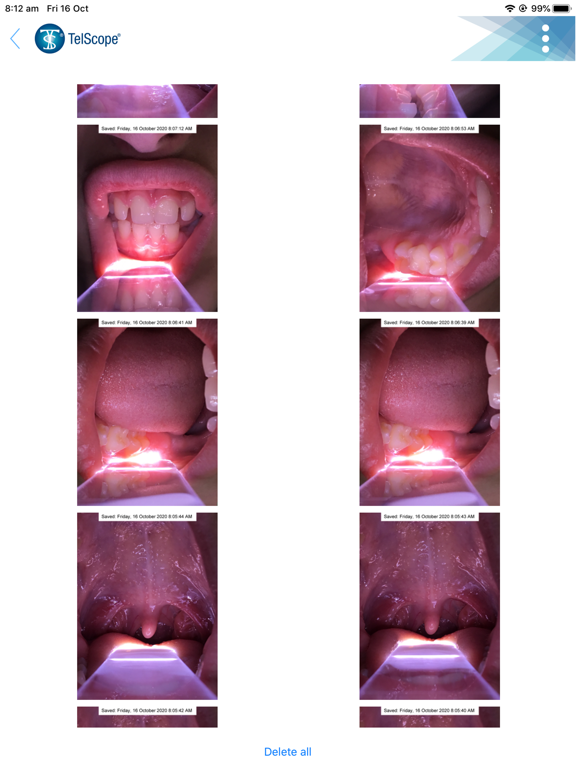 Screenshot #4 pour TelScope