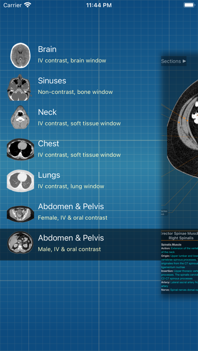 X-Anatomy Pro Screenshot