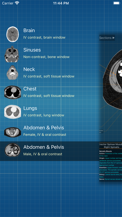 X-Anatomy Proのおすすめ画像1